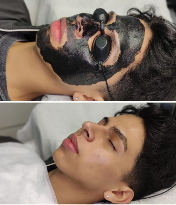 tratamiento facial